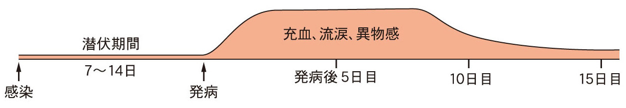 感染してから7日〜14日で症状が現れ、発病後充血、流涙、異物感が現れます