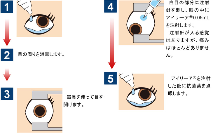 治療当日の流れ